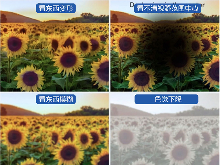 Do you feel like there are shadows in front of you, things are crooked and crooked, and suddenly you can't see clearly?