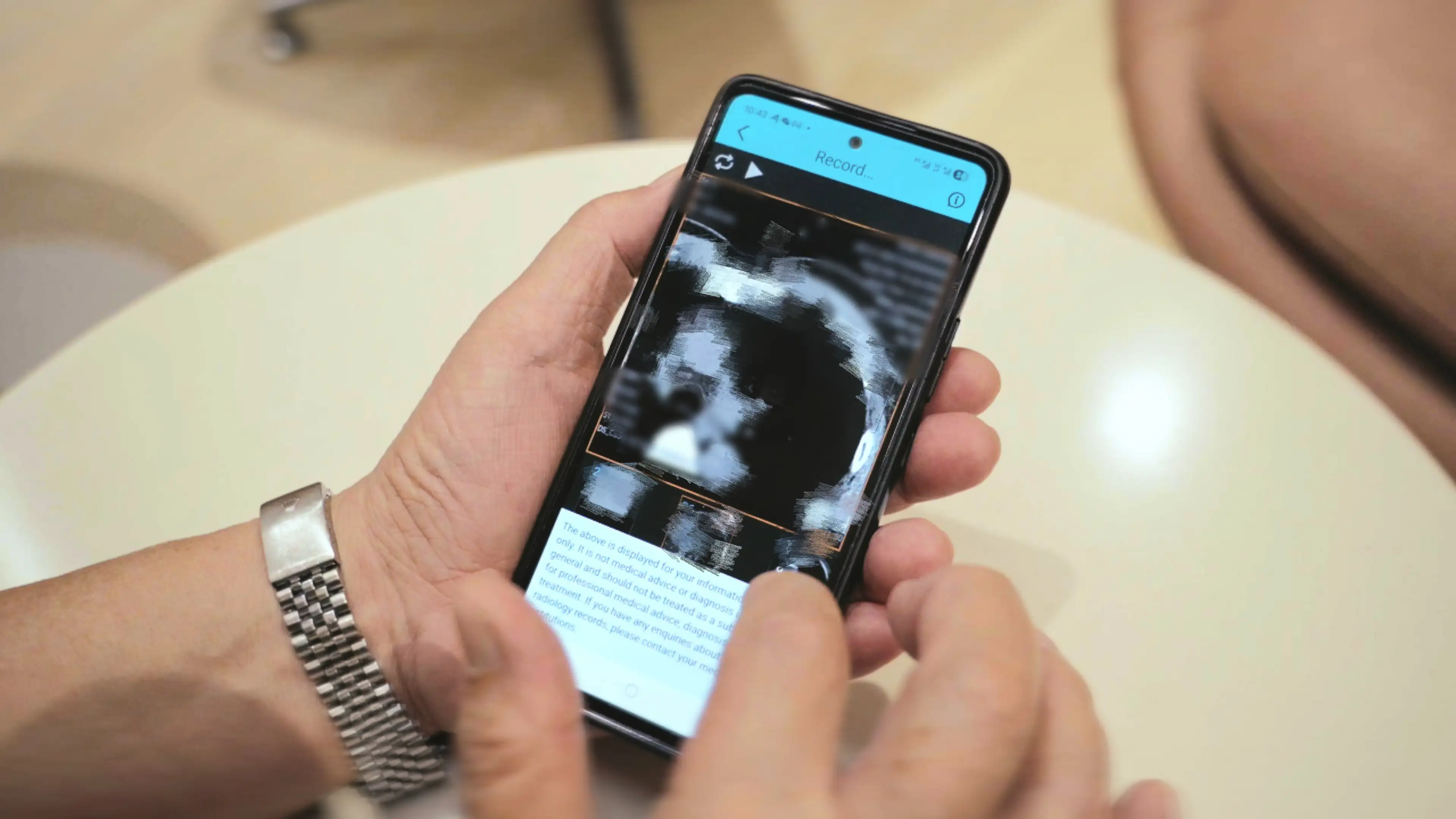 患者登錄醫健通系統便能夠查詢到在內地就診後的放射影像報告